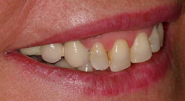 05-G